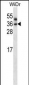 PNPLA4 Antibody (C-term)